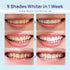 Whitebite Pro Teeth Gel