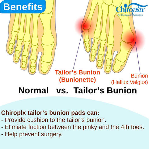 Chiroplax Tailor's Bunion Corrector Pads, Bunionette Pain Relief Separator Cushion for Pinky Toe (4 Pads, Large)