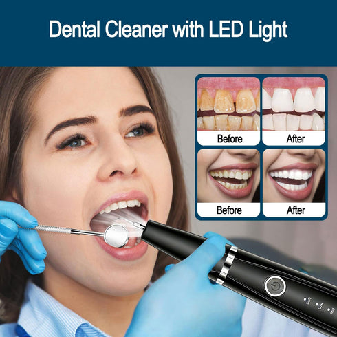 Ujhosld 5 3 IPX6 Sonic Electric Toothbrush, Dental Cleaner with LED Light, Modes Teeth Cleaning Tool, Replaceable Heads
