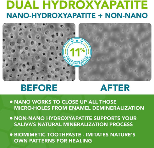 Nano hydroxyapatite Toothpaste Fluoride Free; Dentist Formulated Pro Remineralizing Toothpaste Plus Anti Cavity