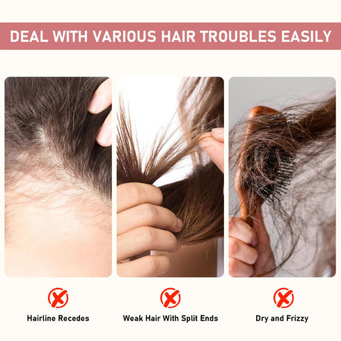 Bello Hair Helper Spray for Thinning Hair - Hair Growth Spray, Rice Water Spray, Restore Dry Damaged Hair, Unisex (2Pcs)