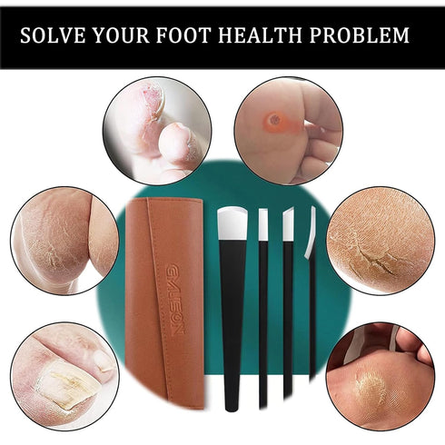 Professional Pedicure Knife Set, Callus Knife for Feet, Ingrown Toenail Knives, Foot Care Tools