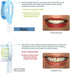 Replacement Toothbrush Brush Heads Compatible with Philips Sonicare - 10 Pack for Snap-On System, Precision Cleaning