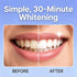 LsardL Teeth,14 (1pc) Lumine Organics Purple whitening Strips,Safe for Sensitive Strips
