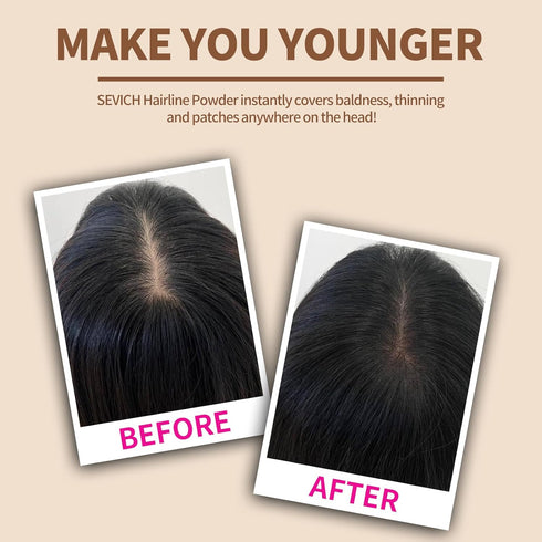 SEVICH Hairline Powder for Thinning Grey Hair, Eyebrows & Beard, Windproof & Sweatproof, Blonde