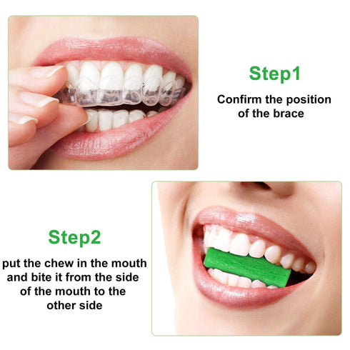 20 Pieces Aligner Tray Seaters for Chompers Orthodontic Trays, Green