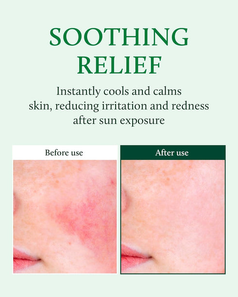 YADAH Cactus Soothing Gel (8.45 fl oz), Sunburn Relief, Calm & Soothe Irritated Skin, 95% Cactus Extract
