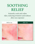 YADAH Cactus Soothing Gel (8.45 fl oz), Sunburn Relief, Calm & Soothe Irritated Skin, 95% Cactus Extract