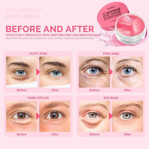 Under Eye Patches for Dark Circles: Caffeine Gel Masks for Puffiness, Wrinkles - Instant Brightening Treatment Pads, 30