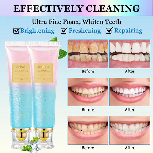 Yicengy 2PCS Niacinamide Toothpaste, Niacinamide Whitening Toothpaste, Niacinamides Intensive Whitening Toothpastes