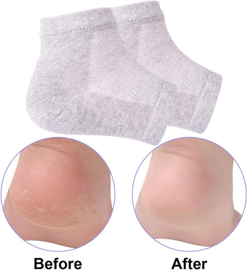 Vented Moisturizing Gel Heel Socks, 3 Pairs Toeless Spa Sock for Foot Care Treatment, Grey, Cracked Heels & Dry Feet
