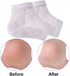Vented Moisturizing Gel Heel Socks, 3 Pairs Toeless Spa Sock for Foot Care Treatment, Grey, Cracked Heels & Dry Feet