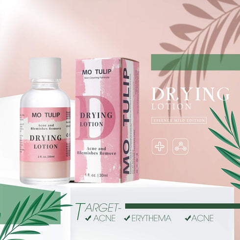 MO TULIP Acne Drying Lotion - Overnight Acne Spot Treatment for Face and Body, 1OZ Pimple Lotion
