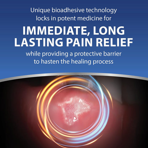 Zilactin-B Fast Acting Oral Pain Relief Gel for Canker Sores, Mouth Sores, and Gum Irritations