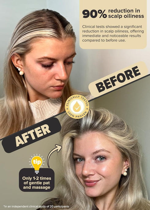 I DEW CARE Dry Shampoo Powder - Tap Secret, Non-aerosol, Travel Size Dry Shampoo for Women, 0.24 oz.
