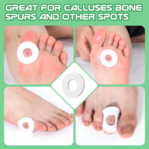 Nuanchu 36 Pcs Callus Cushions Pads for Bottom of Foot, Soft Adhesive Felt Corn Pads for Pain Relief