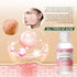 MO TULIP Acne Drying Lotion - Overnight Acne Spot Treatment for Face and Body, 1OZ Pimple Lotion