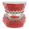 Dental Models Orthodontic Model M7010-2, 1:1 Standard Typodont Teeth with Archwire Ligature Ties, Metal Brackets