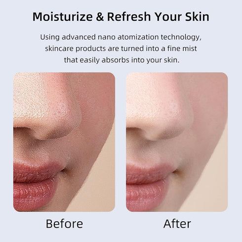 ZJchao Facial Oxygen Injector, Deep Moisturizing Fine Mist Portable Light Spots Oil Control Skin Rejuvenation for Home