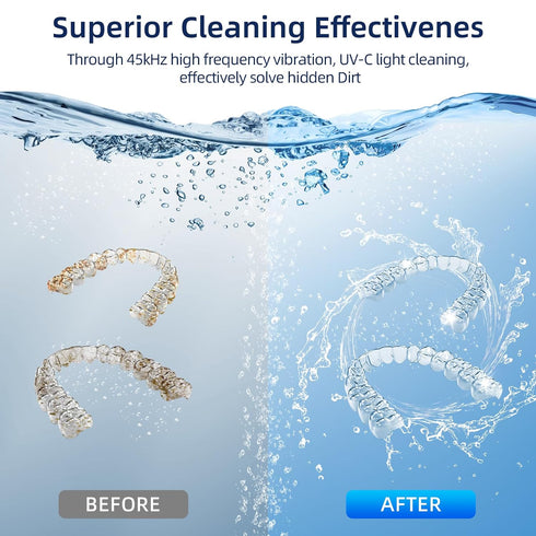 Ultrasonic Retainer Cleaner Machine for Dentures, Mouth Guards, Braces, Toothbrush Heads, Jewelry, 200ML Capacity,