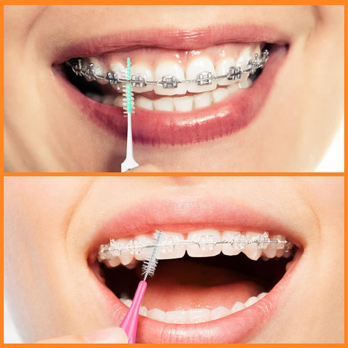 Zopeal 250 Pieces Braces Flossers: Interdental Brush for Cleaner Teeth, Soft Dental Picks Refill Toothpick Cleaners
