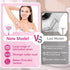 Razors for Women with 2 Non-Slip Handles, 14 Razor Refills, 5 Premium Blades, Disposable Razor with Shower Holder, Pink