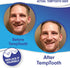 Temptooth #1 Seller, Trusted Patented Temporary Tooth Replacement Product