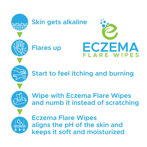 Inflammation 72ct Eczema Flare Wipes - All-Natural Fast Acting Eczema Relief, Anti-Itch, Reduces & Protects Skin