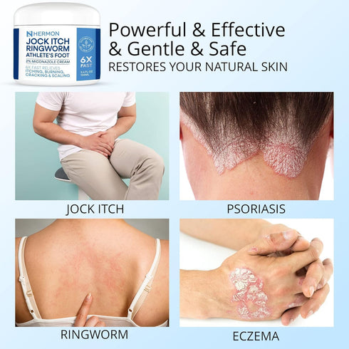 Set: Hermon Jock Itch Antifungal Cream & Spray Ringworm Treatment for Humans, Psoriasis Treatment, Psoriasis Scalp