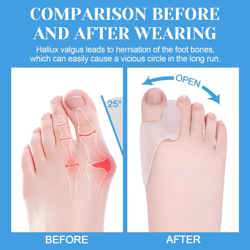 Pack of 6 Bunion Cushion Protector - Reusable Bunion Pads with Separator for Big Toe, Gel Shield for Foot Pain Relief