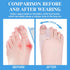 Pack of 6 Bunion Cushion Protector - Reusable Bunion Pads with Separator for Big Toe, Gel Shield for Foot Pain Relief