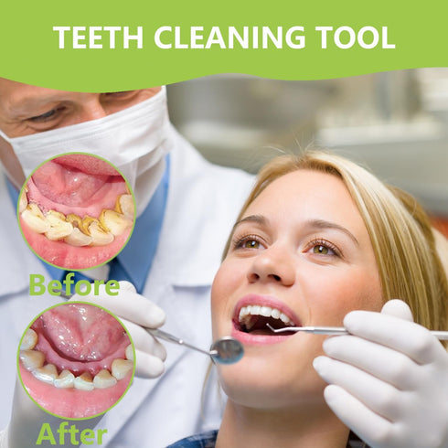 Dental Tools, Professional Teeth Cleaning Oral Care Hygiene Kit, Stainless Steel Dental Pick Tooth Scraper.
