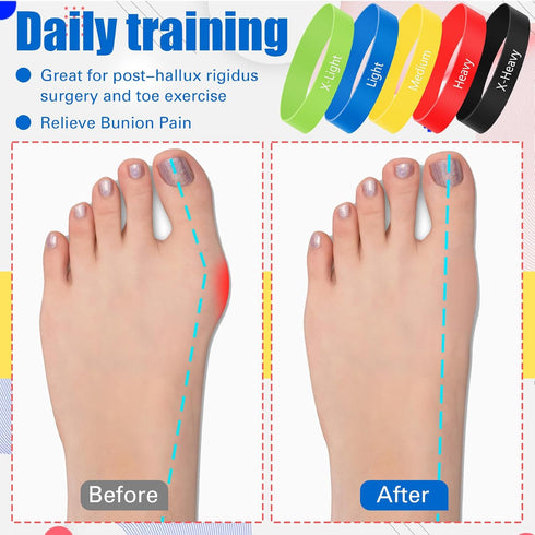 Set 5 WinnerWhy of Toe Stretcher Band Separator Spacer Bunion Correction Hallux Valgus Alignment Foot Stretcher