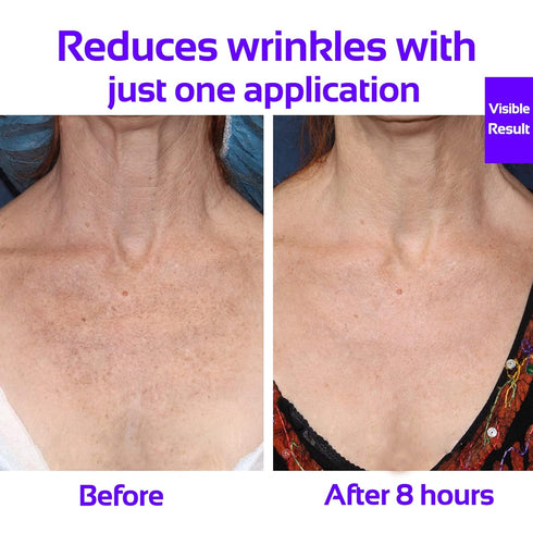 Upgraded Chest Wrinkle Pads, Silicone Pad Set of 3 for Decollete Anti Cleavage Wrinkles, Reusable Treatment Patches