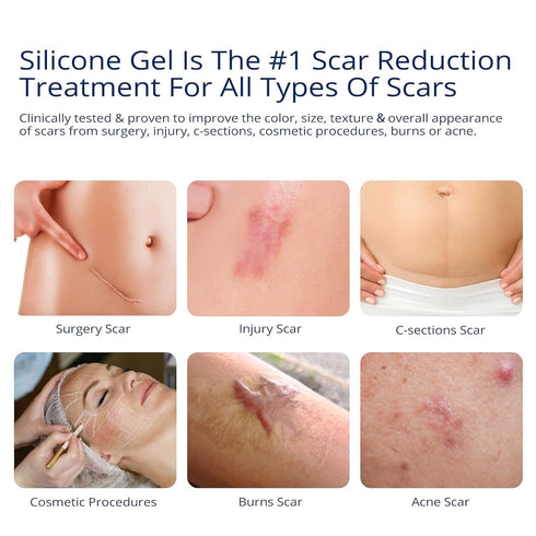 100% Silicone Scar Gel, Advanced Scar Cream for Surgical Scars, C-Section, Stretch Marks, 1.06oz (30g)