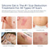 100% Silicone Scar Gel, Advanced Scar Cream for Surgical Scars, C-Section, Stretch Marks, 1.06oz (30g)