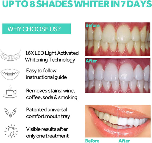 Teeth Whitening Accelerator Light, 16x More Powerful Blue LED Light, Mouth Tray for Home Use