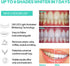 Teeth Whitening Accelerator Light, 16x More Powerful Blue LED Light, Mouth Tray for Home Use