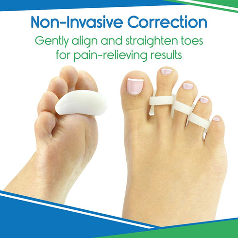 VIVEsole Hammer Toe Corrector, 4pc Cushioned Gel Straightener Loops, Toe Support Cushion Brace for Bunion Foot Relief