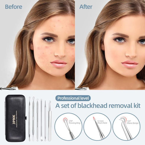 JPNK Blackhead Remover Comedone Extractor, Acne Removal Kit.