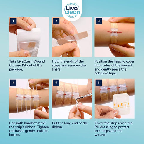 (3 CT) Zip Stitch Wound Closure Strips, Butterfly Kit Device for Skin Closing Adhesive Bandages