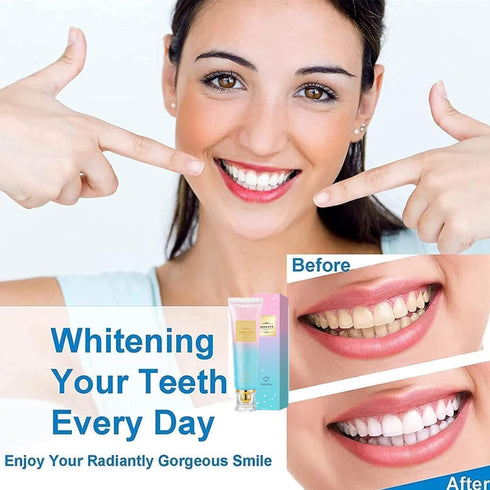 YG LianKai 2PC Niacinamide Toothpaste, Niacinamide Whitening Toothpaste, Intensive Nicotinamide White Teeth, Fresh