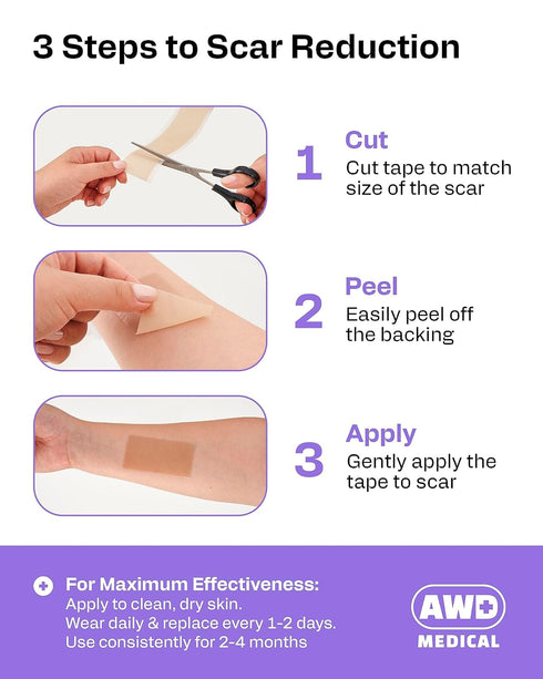 AWD Silicone Scar Sheets for Surgical Scars, Medical Grade Silicone Scar Tape for C Section, 1.6" x 120" Roll