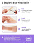 AWD Silicone Scar Sheets for Surgical Scars, Medical Grade Silicone Scar Tape for C Section, 1.6" x 120" Roll