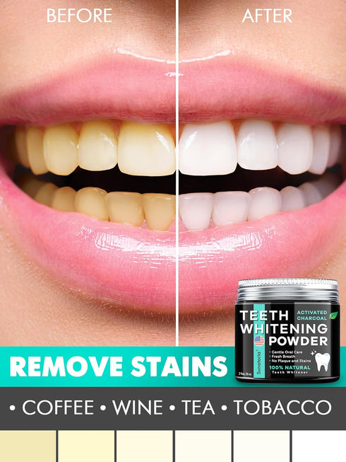 Teeth Whitening Powder, 5 in 1 Remineralizing Tooth Powder for Whitening, Charcoal Toothpaste Alternative