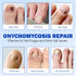 Nyloriaine 42Pcs, (1 Count (Pack 2)) Fungal Nail Patches Toenail Treatment Extra Strength, Nail Repair for Damaged
