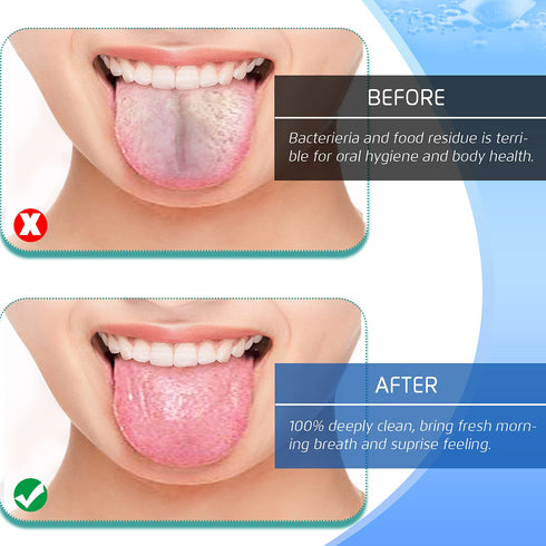 4PCS Stainless Steel Tongue Scrapers, 100% BPA Free Oral Hygiene Brushes, Reusable for Bad Breath