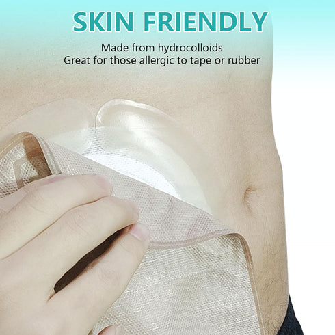 XIIFIIFII 20 Pcs Elastic Ostomy Barrier Strips, Medical Grade Hydrocolloid Waterproof Leak, Pressure Sensitive Skin