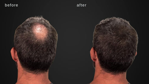 Volumizing Hair Fibers with Real Keratin for Thinning Hair - 60 Days+ Supply - Dermatologist Tested (Medium Brown)