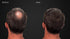 Volumizing Hair Fibers with Real Keratin for Thinning Hair - 60 Days+ Supply - Dermatologist Tested (Medium Brown)